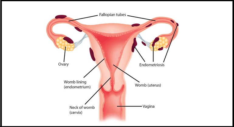 Best Laparoscopy Centres in Pune Best Laparoscopy Centres in Pune